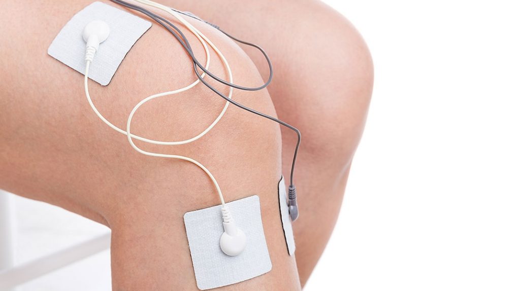 How Electrical Stimulation Is Used in Physical Therapy