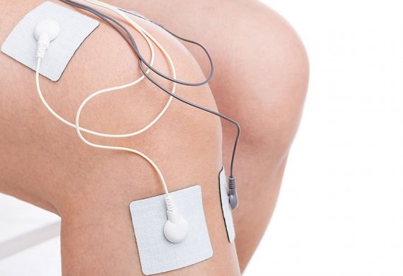 Electrical Stimulation Therapy