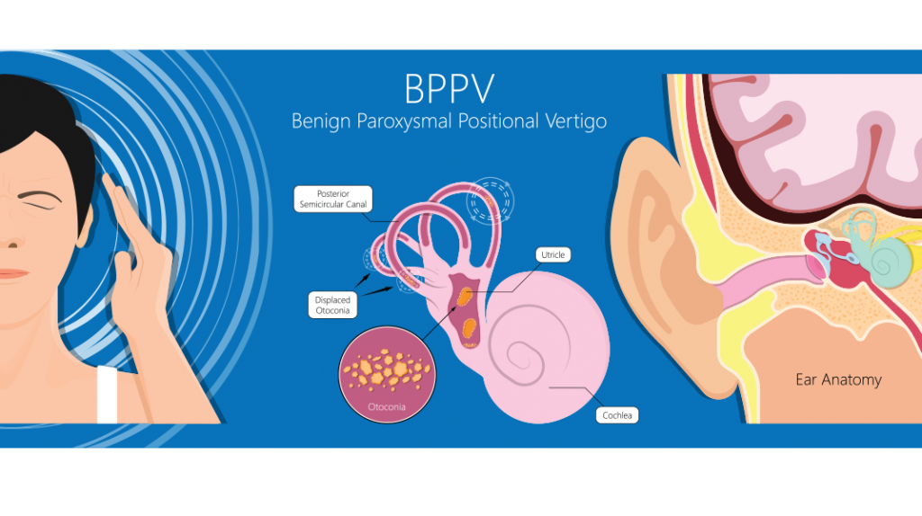 Balance and Vestibular Rehab Treatment